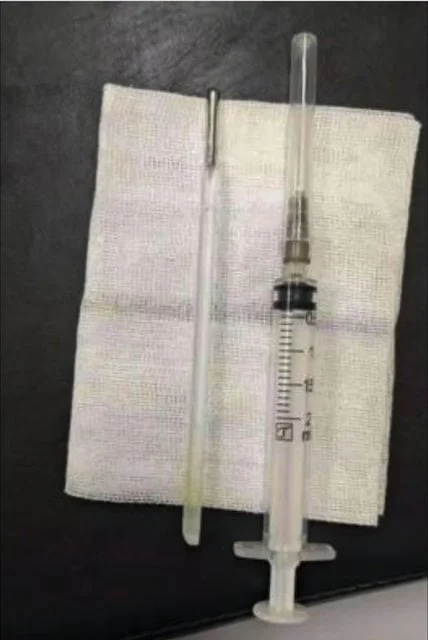 Termómetro de mercúrio extraído intacto ao lado de uma seringa após a cirurgia